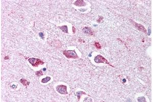 Anti-TLL2 antibody  ABIN1049410 IHC staining of human brain, neurons and glia. (Tolloid-Like 2 抗体  (CUB2 Domain))