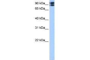 WB Suggested Anti-TMEM24 Antibody Titration:  0. (C2CD2L 抗体  (C-Term))