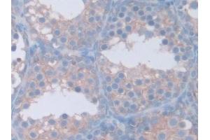Immunohistochemistry (IHC) image for anti-Guanidinoacetate N-Methyltransferase (GAMT) (AA 2-236) antibody (ABIN7444208)