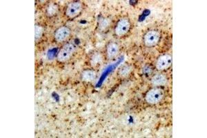 Immunohistochemical analysis of ARFGAP1 staining in rat brain  formalin fixed paraffin embedded tissue section. (ARFGAP1 抗体)