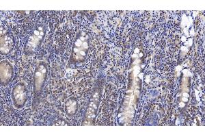 Detection of VF in Human Small intestine Tissue using Monoclonal Antibody to Visfatin (VF) (NAMPT 抗体  (AA 1-491))