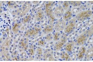 Immunohistochemistry of paraffin-embedded Mouse kidney using GGT1 Polyclonal Antibody at dilution of 1:100 (40x lens). (GGT1 抗体)