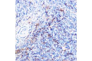 Immunohistochemistry of paraffin-embedded mouse spleen using CD40 Rabbit pAb (ABIN3020703, ABIN3020704, ABIN3020705 and ABIN6213680) at dilution of 1:100 (40x lens). (CD40 抗体)