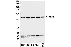 Western Blotting (WB) image for anti-UPF1 Regulator of Nonsense Transcripts Homolog (UPF1) (AA 1079-1129) antibody (ABIN7450651)