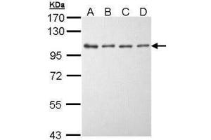 Western Blotting (WB) image for anti-Eukaryotic Elongation Factor-2 Kinase (EEF2K) (N-Term) antibody (ABIN2856812)