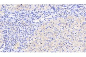 Detection of GKRP in Rat Ovary Tissue using Polyclonal Antibody to Glucokinase Regulatory Protein (GKRP) (GCKR 抗体  (AA 90-286))