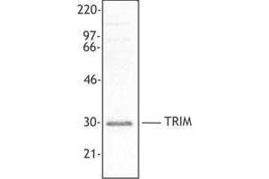 Western Blotting (WB) image for anti-T Cell Receptor Associated Transmembrane Adaptor 1 (TRAT1) (AA 29-186) antibody (ABIN2666376) (TRIM 抗体  (AA 29-186))