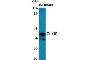 Western Blot (WB) analysis of specific cells using Cdk10 Polyclonal Antibody. (CDK10 抗体  (Internal Region))