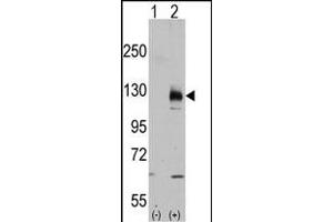Western Blotting (WB) image for anti-Transient Receptor Potential Cation Channel, Subfamily M, Member 8 (TRPM8) (AA 926-956), (C-Term) antibody (ABIN392821)