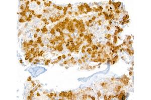Immunohistochemistry (IHC) image for anti-Lymphocyte Antigen 6 Complex, Locus G (Ly6g) antibody (ABIN7448893) (Ly6g 抗体)