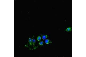 Immunofluorescent analysis of Hela cells using ABIN7148902 at dilution of 1:100 and Alexa Fluor 488-congugated AffiniPure Goat Anti-Rabbit IgG(H+L) (CDK7 抗体  (AA 212-341))