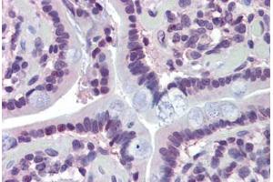 Human Small Intestine (formalin-fixed, paraffin-embedded) stained with MAZ antibody ABIN462205 followed by biotinylated goat anti-rabbit IgG secondary antibody ABIN481713, alkaline phosphatase-streptavidin and chromogen. (MAZ 抗体  (N-Term))