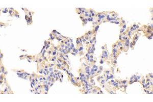 Detection of TLR5 in Human Lung Tissue using Polyclonal Antibody to Toll Like Receptor 5 (TLR5) (TLR5 抗体  (AA 303-514))