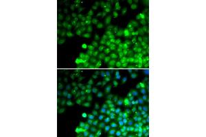 Immunofluorescence analysis of MCF7 cell using TAGLN2 antibody. (TAGLN2 抗体)