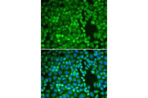 Immunofluorescence analysis of A549 cells using IDE antibody (ABIN5970800). (IDE 抗体)