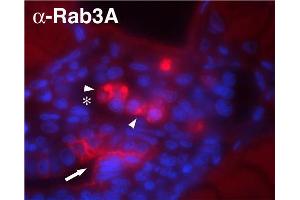 Indirect immunolabeling of methanol/DMSO fixed zebrafish glomerulus. (RAB3A 抗体  (AA 2-14))