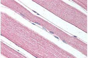 Immunohistochemical staining of human skeletal muscle with PROKR1 polyclonal antibody . (Prokineticin Receptor 1 抗体  (N-Term))