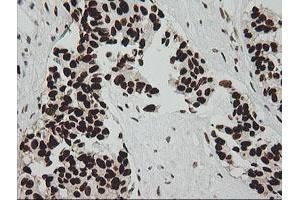 Image no. 8 for anti-Zinc Finger and SCAN Domain Containing 18 (ZSCAN18) antibody (ABIN1501857)