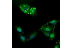 Immunofluorescence (IF) image for anti-alpha-Fetoprotein (AFP) (AA 19-397) antibody (ABIN2716008) (alpha Fetoprotein 抗体  (AA 19-397))