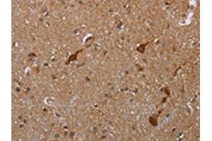 The image is immunohistochemistry of paraffin-embedded human brain tissue using ABIN7190062(CASP8AP2 Antibody) at dilution 1/20. (FLASH 抗体)