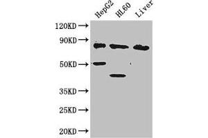 Western Blot Positive WB detected in: HepG2 whole cell lysate, HL60 whole cell lysate, Mouse liver tissue All lanes: PFKL antibody at 2. (PFKL 抗体  (AA 229-479))