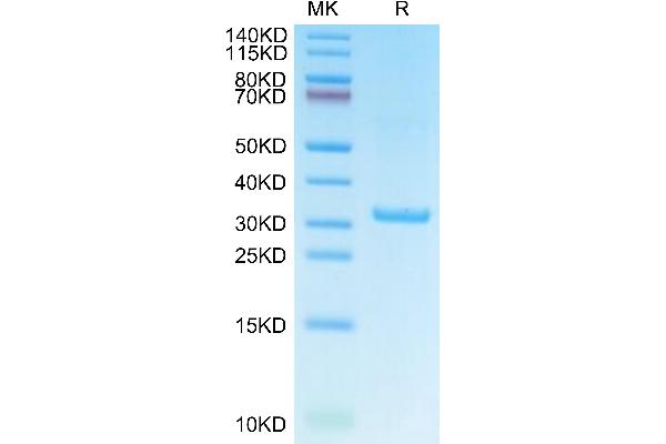 IgE Protein (AA 209-428) (His-Avi Tag)