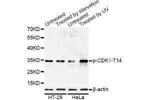 Western blot analysis of extracts of HT-29 and HeLa cells, using Phospho-CDK1-T14 antibody. (CDK1 抗体  (pThr14))