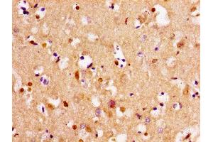 Immunohistochemistry of paraffin-embedded human brain tissue using ABIN7171992 at dilution of 1:100 (TPMT 抗体  (AA 4-244))