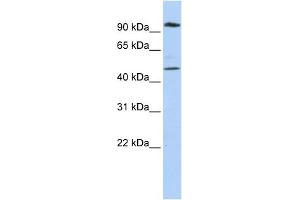 WB Suggested Anti-MARCH4 Antibody Titration:  0. (MARCH4 抗体  (N-Term))
