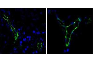 Immunofluorescence analysis of paraffin-embedded human lung cancer(left) and breast cancer(right) cells using CD31 mouse mAb (green). (CD31 抗体)