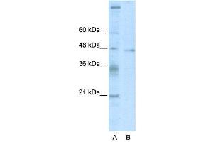 WB Suggested Anti-TSG101  Antibody Titration: 2. (TSG101 抗体  (C-Term))