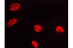 ABIN6267319 staining HeLa cells by ICC/IF. (Progesterone Receptor 抗体  (pSer400))