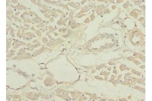 Immunohistochemistry of paraffin-embedded human heart tissue using ABIN7166902 at dilution of 1:100 (PDHB 抗体  (AA 1-300))