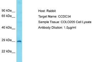 Host: Rabbit Target Name: CCDC34 Sample Type: COLO205 Whole Cell lysates Antibody Dilution: 1. (CCDC34 抗体  (C-Term))