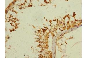 Immunohistochemistry (IHC) image for anti-Ankyrin Repeat and Sterile alpha Motif Domain Containing 1B (ANKS1B) (AA 999-1248) antibody (ABIN7144207)