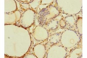 Immunohistochemistry of paraffin-embedded human thyroid tissue using ABIN7171903 at dilution of 1:100 (TTC12 抗体  (AA 1-260))