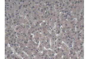 Immunohistochemistry (IHC) image for anti-Amiloride Binding Protein 1 (Amine Oxidase (Copper-Containing)) (ABP1) (AA 27-113) antibody (ABIN7432328)