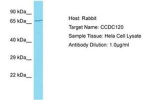 Image no. 1 for anti-Coiled-Coil Domain Containing 120 (CCDC120) (AA 329-378) antibody (ABIN6750717) (CCDC120 抗体  (AA 329-378))