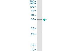 CTGF monoclonal antibody (M01), clone 2C11. (CTGF 抗体  (AA 31-251))