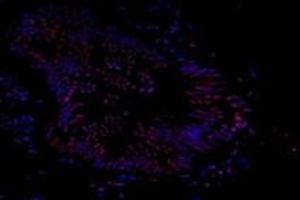 Immunofluorescent analysis of paraformaldehyde-fixed human prostate using Ring1A (ABIN7075467) at dilution of 1: 800 (RING1 抗体)