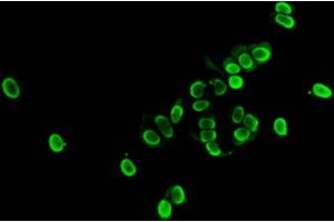 Immunofluorescent analysis of MCF-7 cells (sodium butyrate, 30 mM, 4h) using ABIN7139177 at dilution of 1:100 and Alexa Fluor 488-congugated AffiniPure Goat Anti-Rabbit IgG(H+L) (HIST1H1E 抗体  (acLys33))