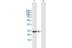 Western Blot analysis of RAET1G expression in transfected 293T cell line by RAET1G MaxPab polyclonal antibody. (Retinoic Acid Early Transcript 1G (RAET1G) (AA 1-213) 抗体)