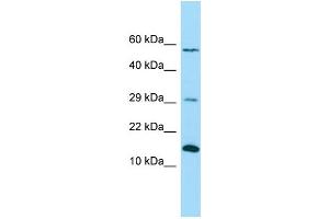 WB Suggested Anti-NDUFB4 Antibody Titration: 1. (NDUFB4 抗体  (C-Term))