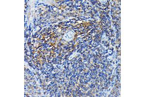 Immunohistochemistry (IHC) image for anti-Protein Regulator of Cytokinesis 1 (PRC1) (AA 351-620) antibody (ABIN6146124)