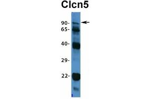 Host:  Rabbit  Target Name:  Clcn5  Sample Type:  Mouse Brain  Antibody Dilution:  1.
