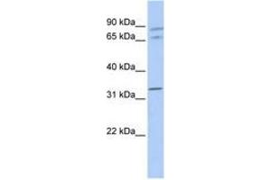 Image no. 1 for anti-Gap Junction Protein, alpha 4, 37kDa (GJA4) (AA 108-157) antibody (ABIN6740499) (GJA4 抗体  (AA 108-157))