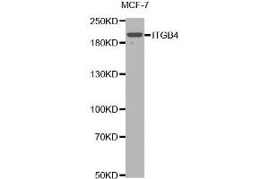 Western blot analysis of extracts of MCF7 cells lines, using ITGB4 antibody. (Integrin beta 4 抗体  (AA 28-310))