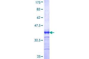 DDX3Y Protein (AA 1-80) (GST tag)