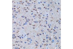 Immunohistochemistry of paraffin-embedded rat brain using IRAK4 antibody. (IRAK4 抗体  (AA 1-220))