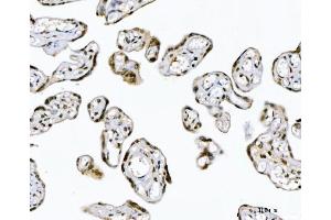 IHC analysis of GADD45B using anti-GADD45B antibody (ABIN7603219).